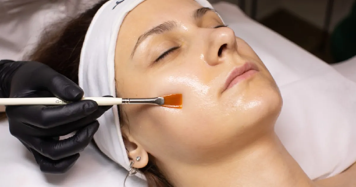Women receiving Chemical Peels in Freeland, MI