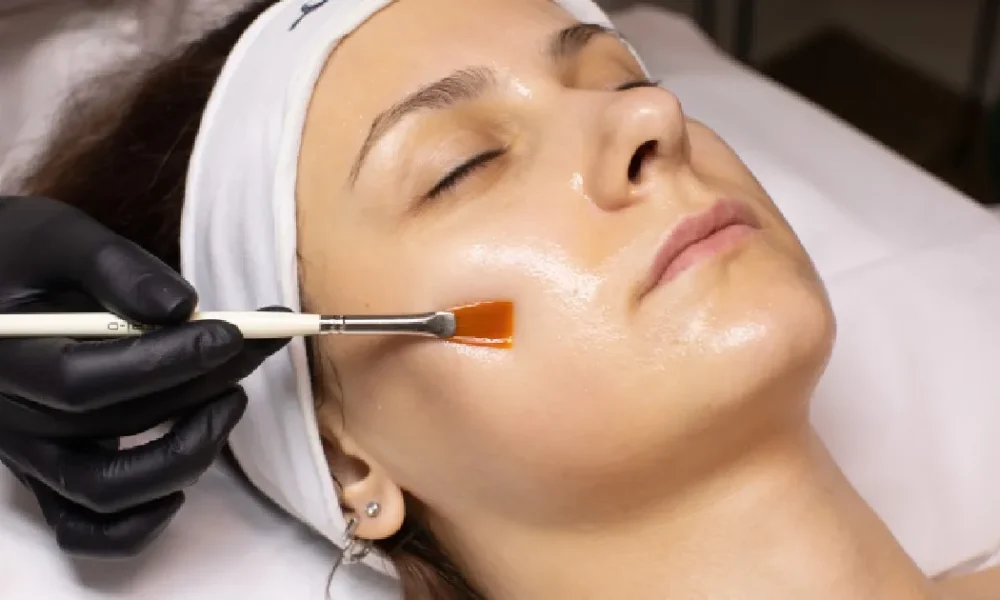 Women receiving Chemical Peels in Freeland, MI
