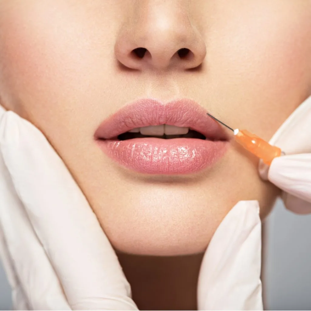 Dermal Fillers in Freeland, MI at Evolution Aesthetics