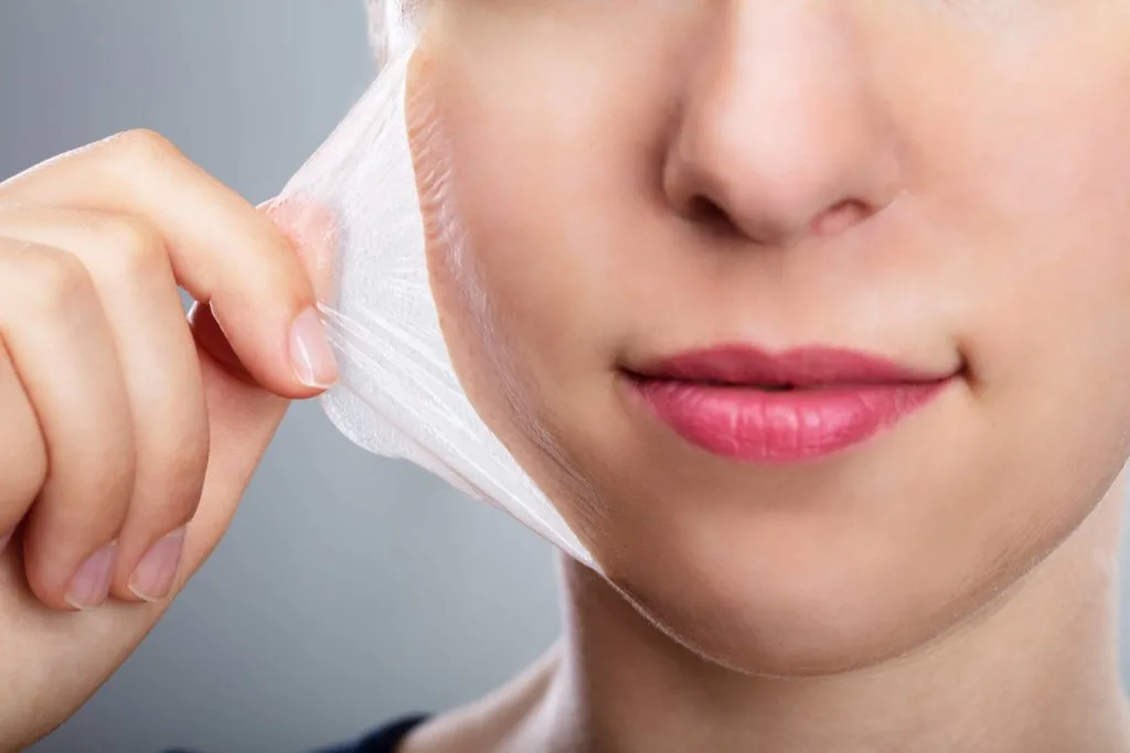 Chemical Peels in Freeland, MI at Evolution Aesthetics