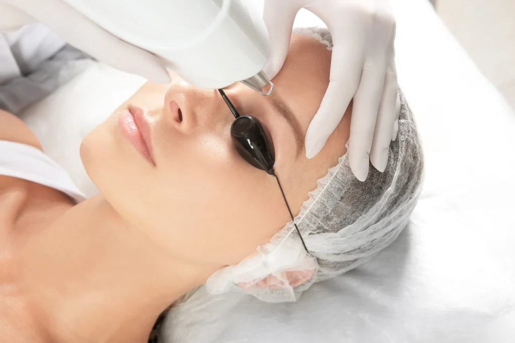 Microblading Removal Treatment in Freeland MI at Evolution Aesthetics